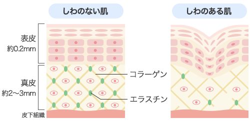 新型スーパーコラーゲン注射